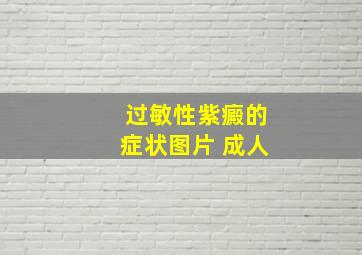 过敏性紫癜的症状图片 成人